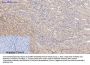 Rock-1 Antibody