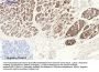 Rock-1 Antibody