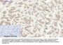 Rock-1 Antibody