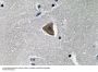 Rock-1 Antibody