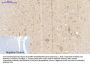 Rock-1 Antibody