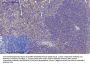 Rock-1 Antibody