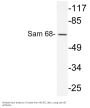 Sam 68 Antibody