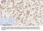 SOCS-1 Antibody