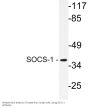 SOCS-1 Antibody