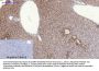 SOCS-1 Antibody