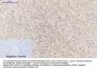 SOCS-1 Antibody