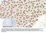 SOCS-1 Antibody