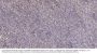 SOCS-2 Antibody