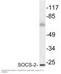 SOCS-2 Antibody