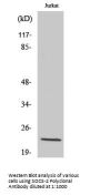SOCS-2 Antibody