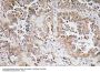 Synphilin-1 Antibody