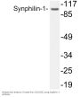 Synphilin-1 Antibody