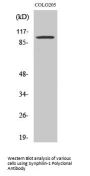 Synphilin-1 Antibody