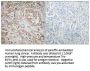 Synphilin-1 Antibody