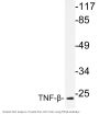 TNF-β Antibody
