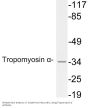Tropomyosin α Antibody