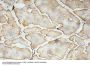 VEGF-A Antibody