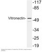 Vitronectin Antibody