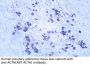 Adrenocorticotropin(ACTH) (ABT-ACTH) Antibody