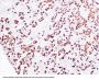 Adrenocorticotropin(ACTH) (ABT-ACTH) Antibody