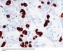 Adrenocorticotropin(ACTH) (ABT-ACTH) Antibody