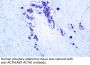 Adrenocorticotropin(ACTH) (ABT-ACTH) Antibody