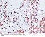 Adrenocorticotropin(ACTH) (ABT-ACTH) Antibody