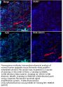 Actin, smooth muscle (SMA) (ABT-SMA) Antibody