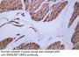 Actin, smooth muscle (SMA) (ABT-SMA) Antibody