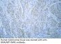 Actin, smooth muscle (SMA) (ABT-SMA) Antibody