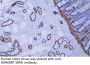Actin, smooth muscle (SMA) (ABT-SMA) Antibody