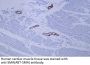 Actin, smooth muscle (SMA) (ABT-SMA) Antibody