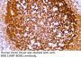 BOB.1 (ABT-BOB1) Antibody