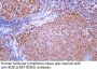 BOB.1 (ABT-BOB1) Antibody