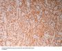 Calretinin (ABT-Calret 1) Antibody