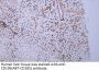 CD105 (ABT-CD105) Antibody