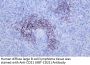 CD21 (ABT-CD21) Antibody