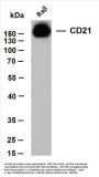 CD21 (ABT-CD21) Antibody