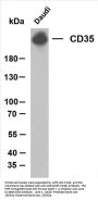 CD35 (ABT-CD35) Antibody