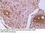 CD45 (ABT-CD45) Antibody