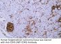 CD45 (ABT-CD45) Antibody