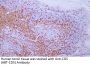 CD5 (ABT-CD5) Antibody