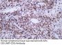 CD5 (ABT-CD5) Antibody