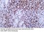 CD5 (ABT-CD5) Antibody