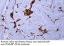Carcinoembryonic antigen (ABT-CEA) Antibody