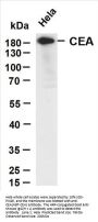 Carcinoembryonic antigen (ABT-CEA) Antibody