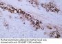 Carcinoembryonic antigen (ABT-CEA) Antibody