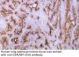 Carcinoembryonic antigen (ABT-CEA) Antibody