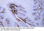 Carcinoembryonic antigen (ABT-CEA) Antibody